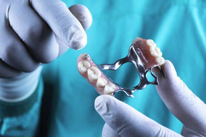 La prótesis dental removible como tratamiento de implantología