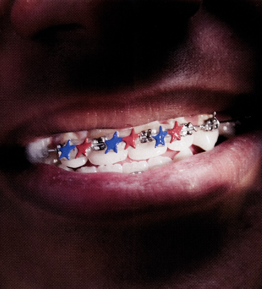 brackets lamine yamal