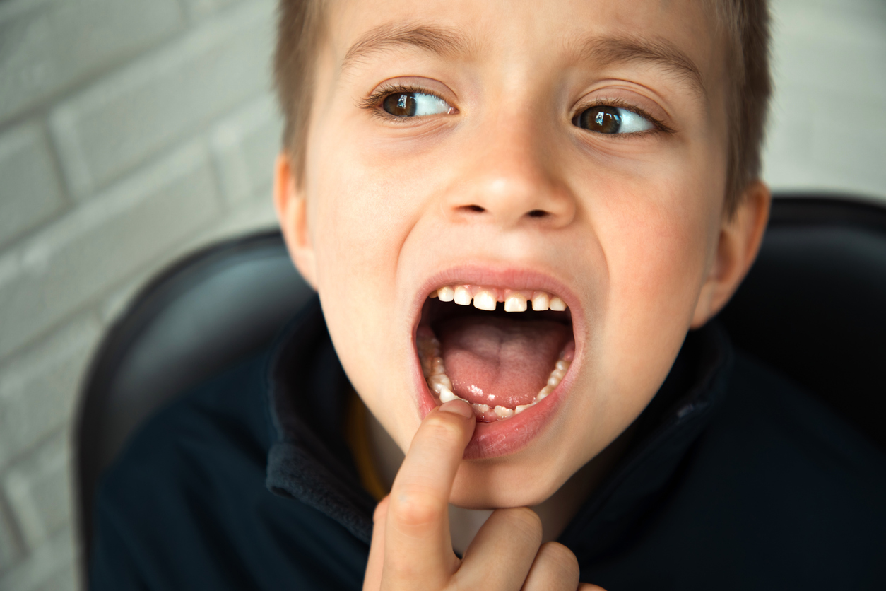 dientes de leche